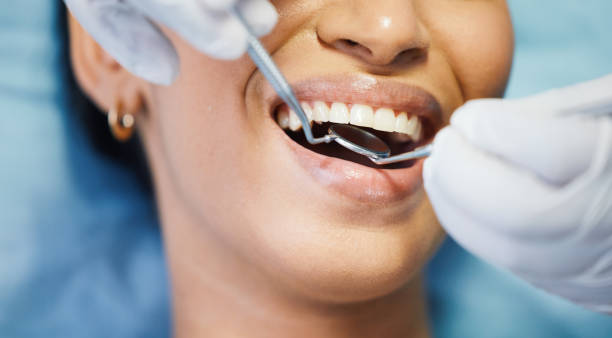 Best Emergency Dental Extractions in Belwood, NC